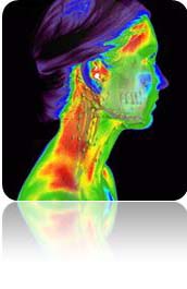 Thermography Image